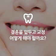[Q&A] 결혼식을 앞두고 벌어진 앞니가 고민이에요 관련 이미지 8