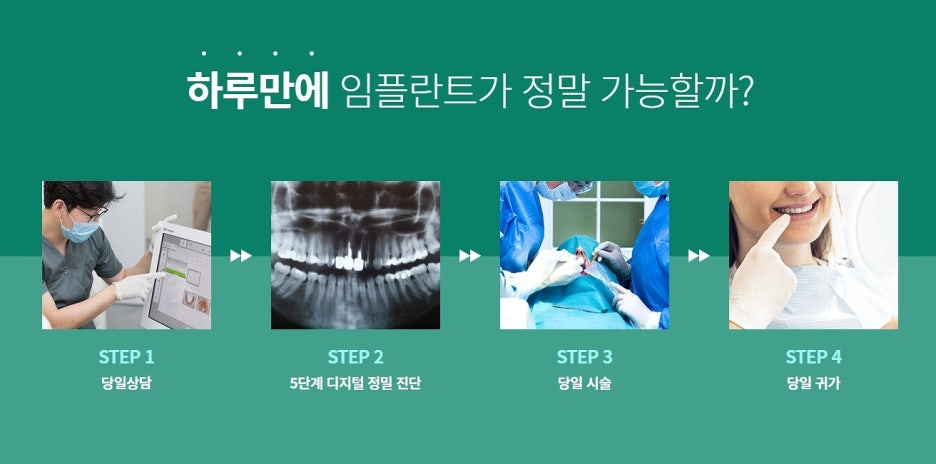 원데이임플란트 관심이 생겼을 경우 관련 이미지 4