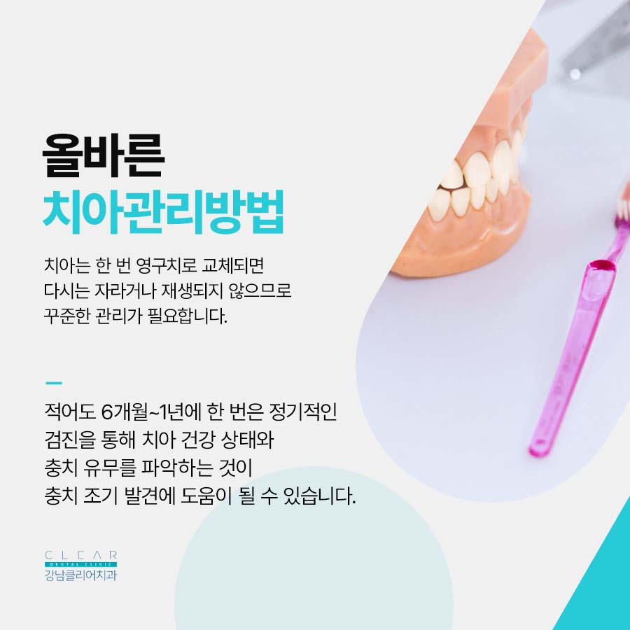 치아보철치료 종류 단계에 따라 관련 이미지 6