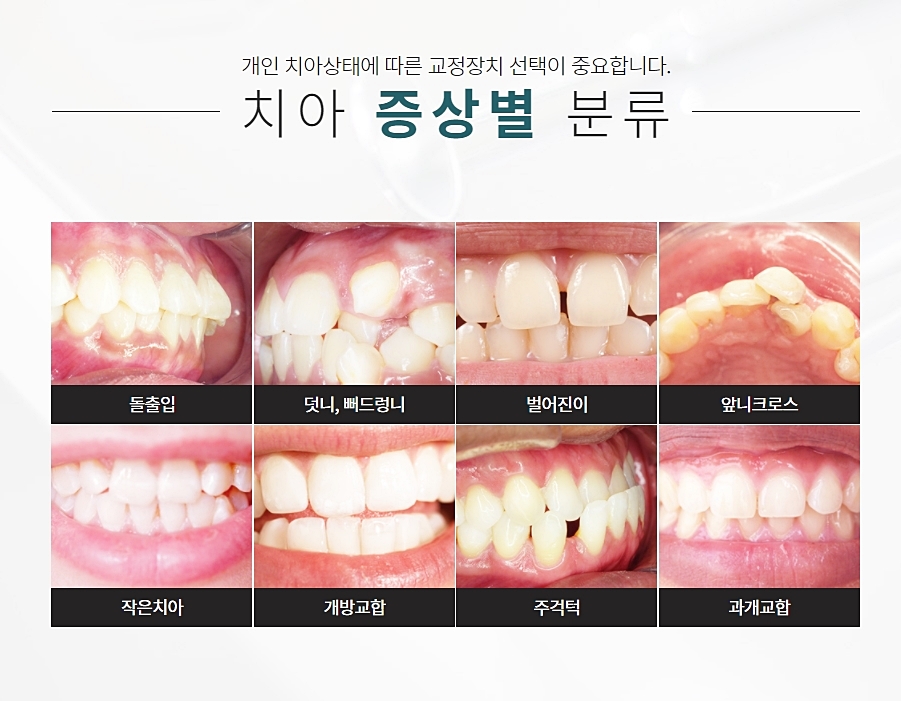 강남역 클리피씨 궁금증을 해결하길 원해 관련 이미지 6