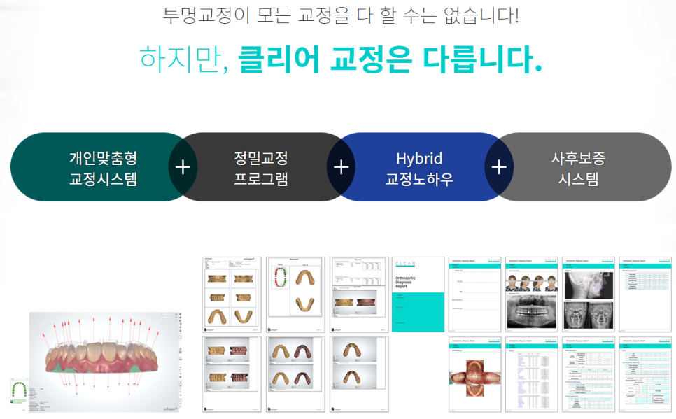 도곡동치아교정치과 보기좋은 치열을 원한다면 관련 이미지 7