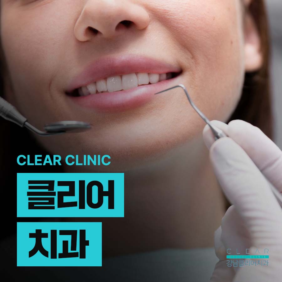 클리어치과 스케일링 주기 놓치지 말고 관련 이미지 1