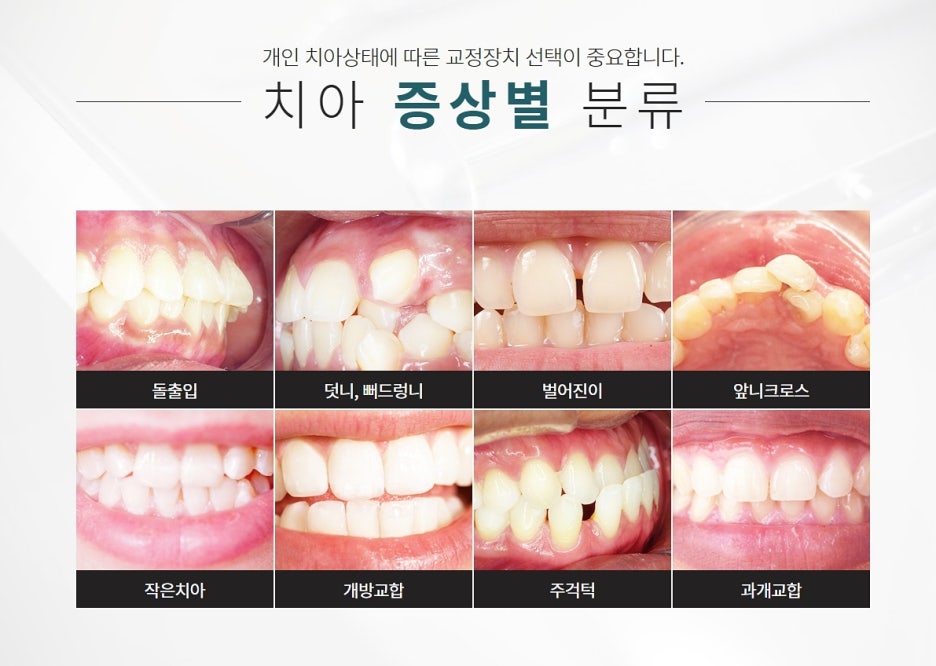 강남역 치아교정 정밀하게 다가가는 곳과 관련 이미지 7