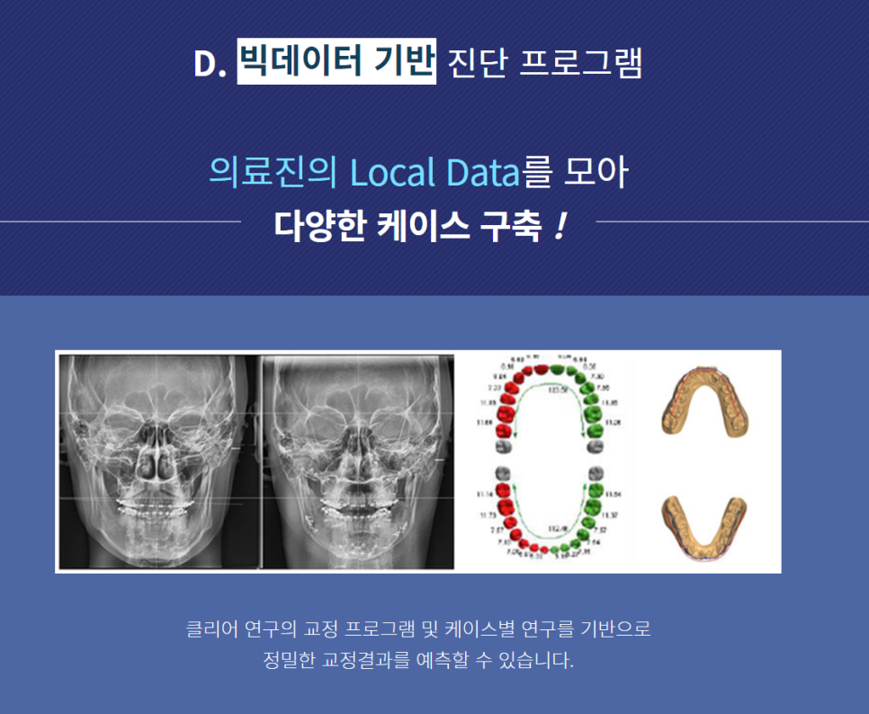 강남역 교정치과 치열을 예쁘고 고르게! 관련 이미지 6