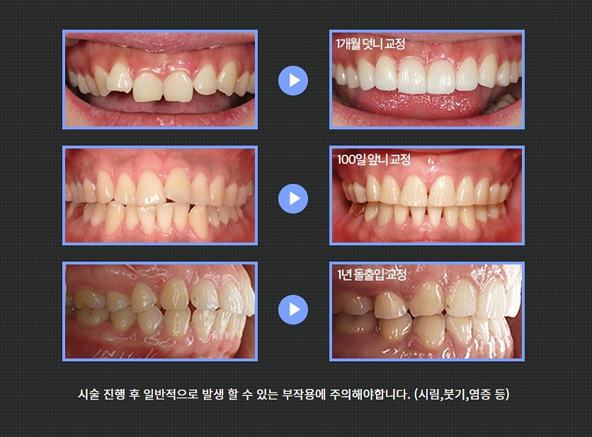 강남역 치아교정 정밀하게 다가가는 곳과 관련 이미지 8