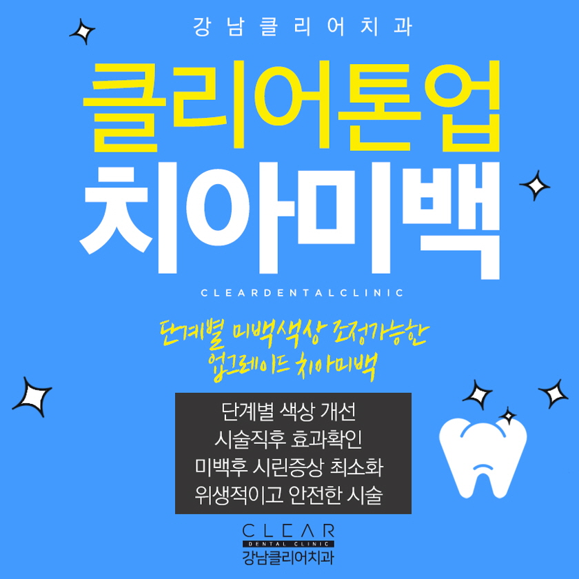 강남역 치과 치아미백 어떻게 다른걸까? 관련 이미지 1
