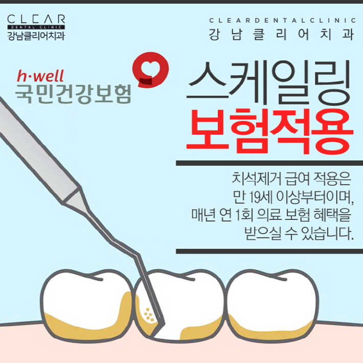치아 스케일링 가격 건강보험 적용으로 부담없이 관련 이미지 5