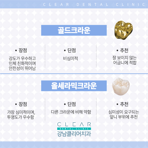강남역치과 추천 치아 보철치료 관련 이미지 5