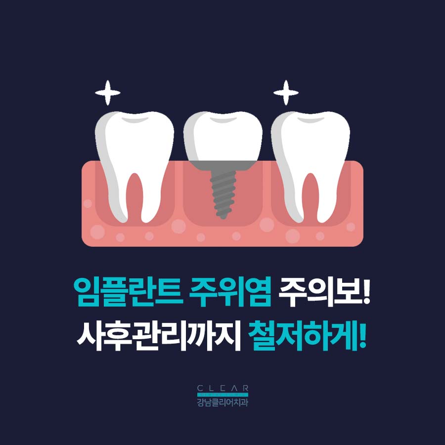 논현동 임플란트 주위염 증상 예방법 관련 이미지 2