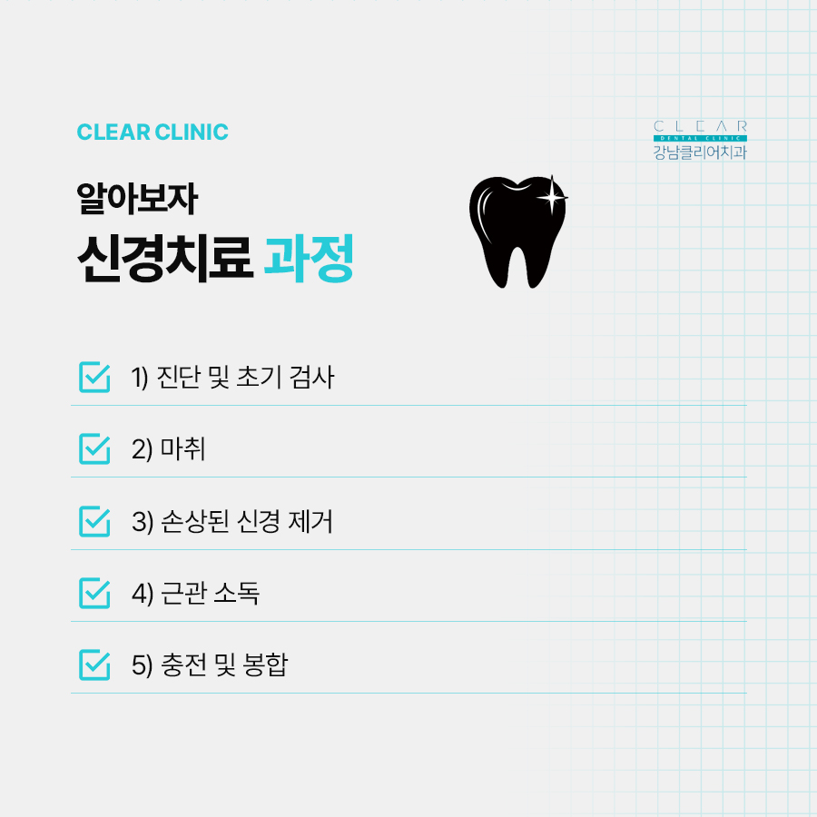 신경치료 후 통증이 생기는 이유 관련 이미지 2