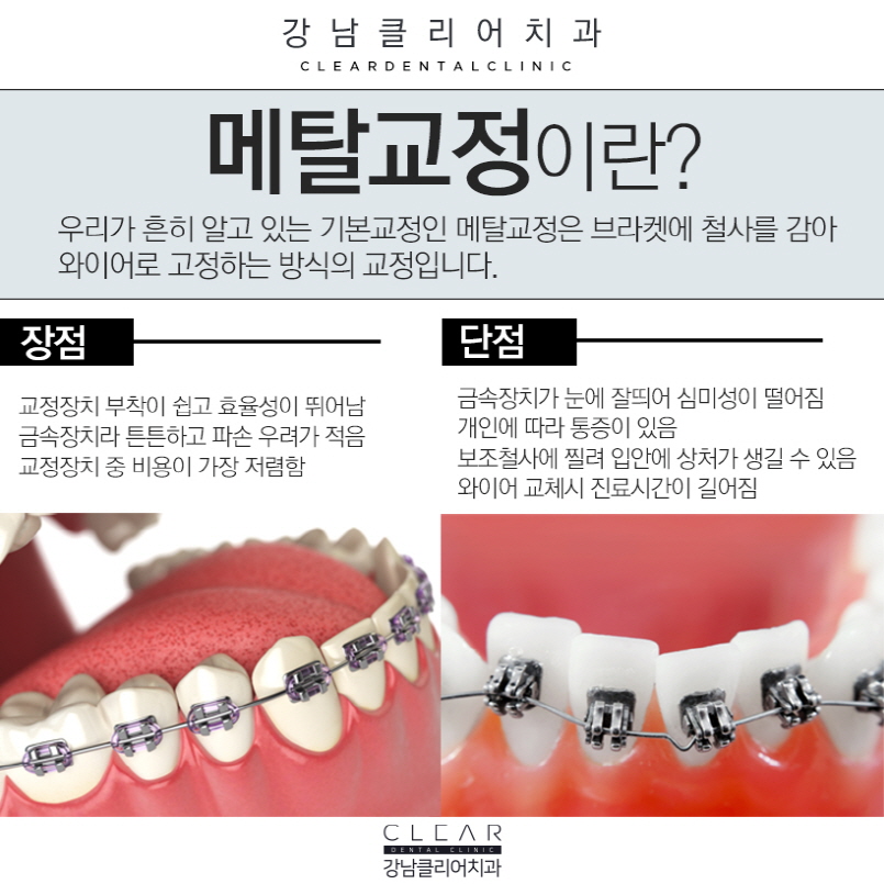 강남역치과 11가지 약속과 8단계 프로세스 관련 이미지 4