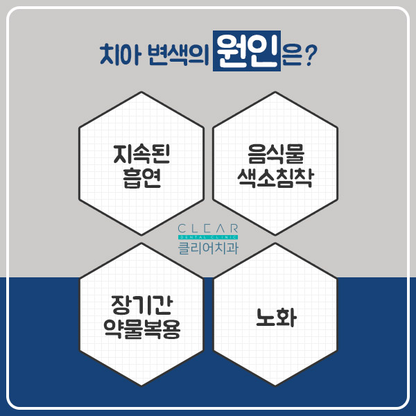 반짝반짝 눈이 부시는 클리어 치아미백 관련 이미지 2