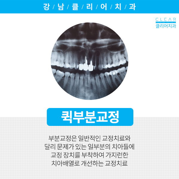 전체교정말고 부분적으로 할 수는 없을까요? 관련 이미지 2