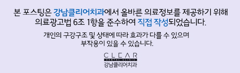바르고 고른 치아 라미네이트로 만들기 관련 이미지 11