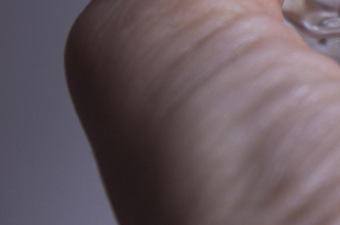 당일 임플란트 조건 무엇이 필요할까 관련 이미지 22