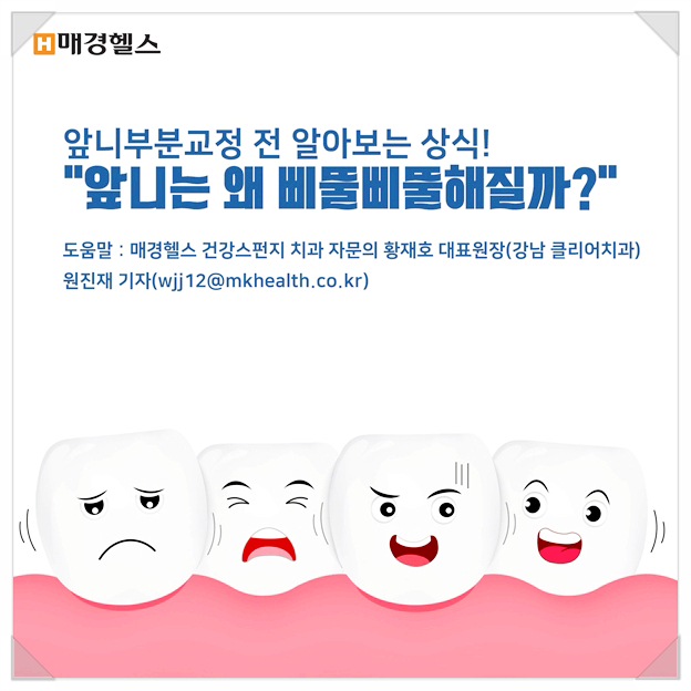 클리어 치과 상식 - 앞니 부분교정 전 꿀팁! 관련 이미지 1