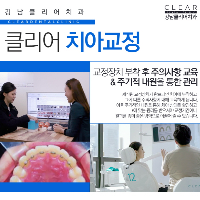 치아부분교정 앞니부분교정 정확한 진단이 중요 관련 이미지 6