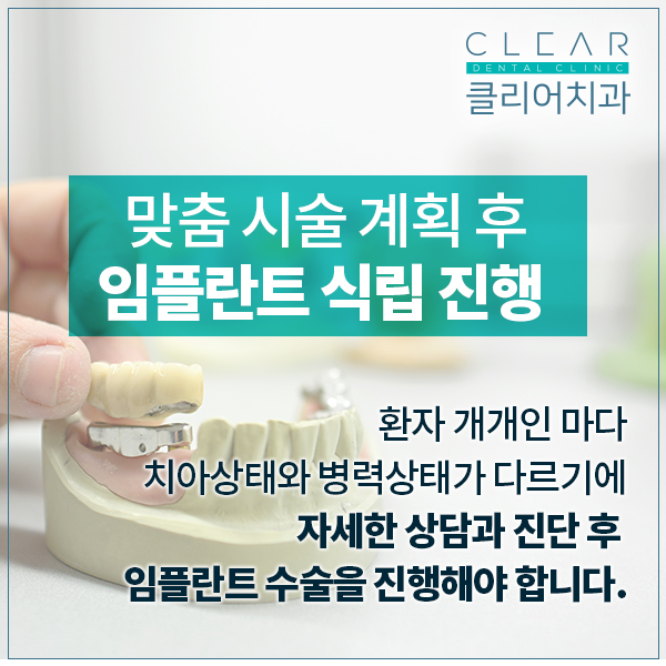 65세이상, 보험혜택으로 임플란트 시작하세요! 관련 이미지 3