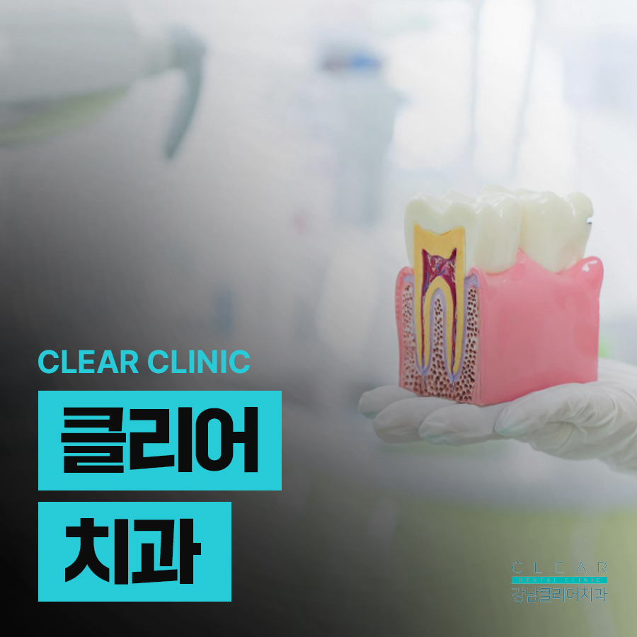 클리어치과 오스템임플란트 정품을 사용하니까 관련 이미지 1