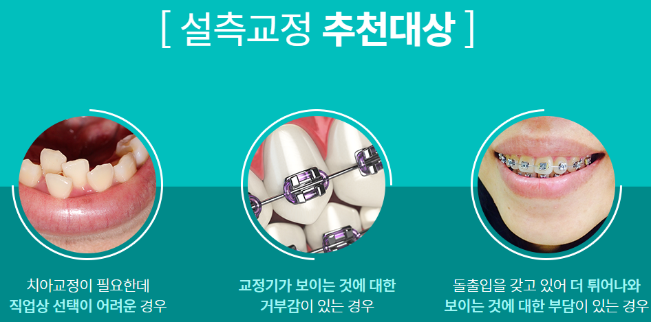 강남교정치과 치아라인을 반듯하게! 관련 이미지 5