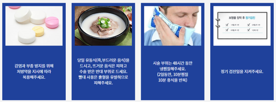 논현동임플란트치과 오래 사용할 수 있도록 관련 이미지 8