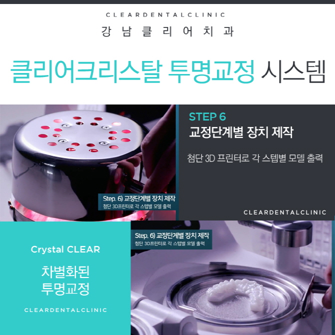 강남역투명교정 차별화된 클리어크리스탈 투명교정 알아보기 관련 이미지 9