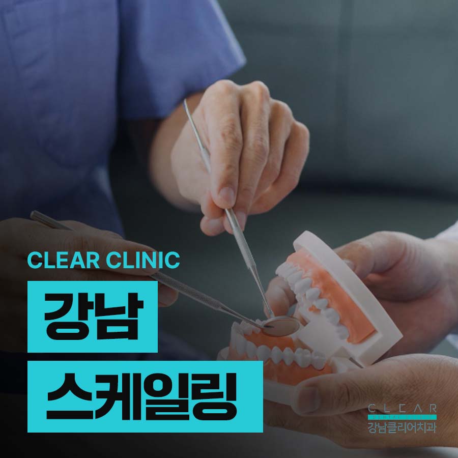 강남 스케일링 치석제거 필요한 이유 정리 관련 이미지 1