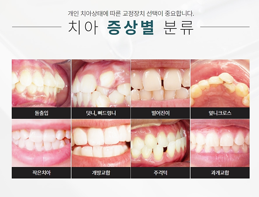 강남역 클리피씨교정 합리적이어야 해 관련 이미지 4