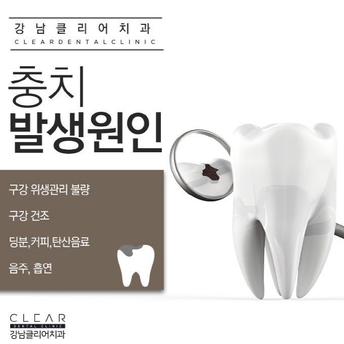 강남역충치치료 단계별 달리지는 치료방법 관련 이미지 3