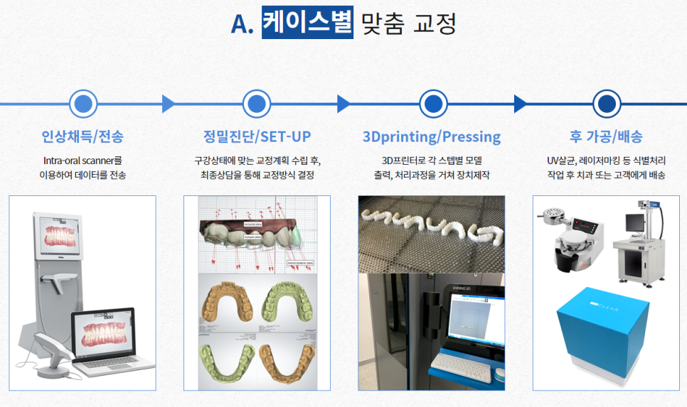 강남투명교정 보철에 대한 부담을 적게! 관련 이미지 4