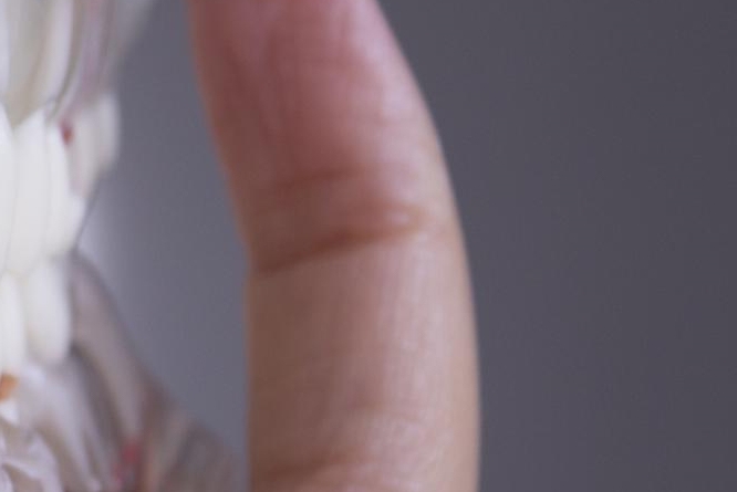 당일 임플란트 조건 무엇이 필요할까 관련 이미지 21