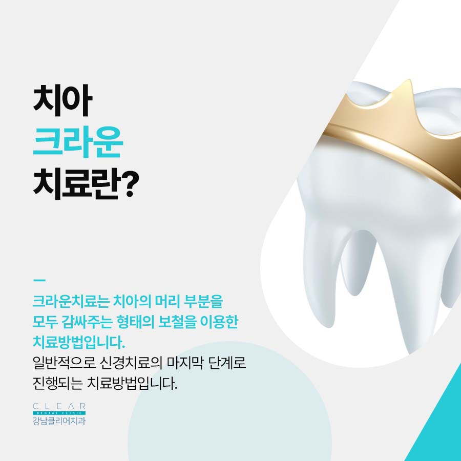 충치 크라운 수명 오래 사용하려면 관련 이미지 2