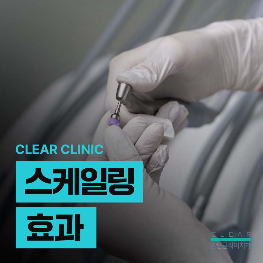스케일링 효과 이러한 장점들이 있어요 관련 이미지 1