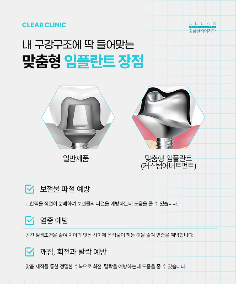 강남 논현동 임플란트 맞춤형으로 나한테 꼭 맞게 관련 이미지 3