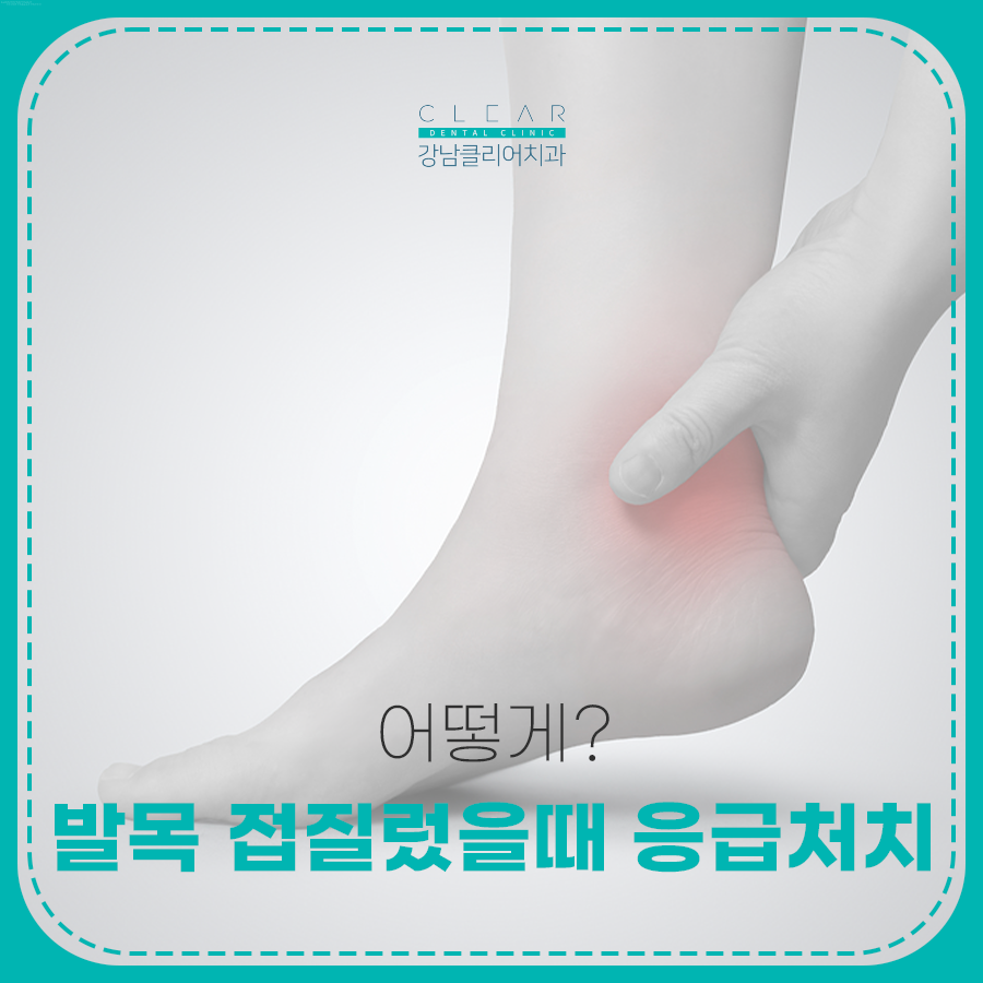 발목 접질렀을때 응급처치 어떻게? 관련 이미지 1