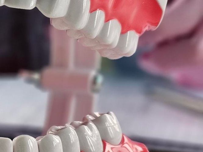 신경치료 후 통증이 생기는 이유 관련 이미지 20