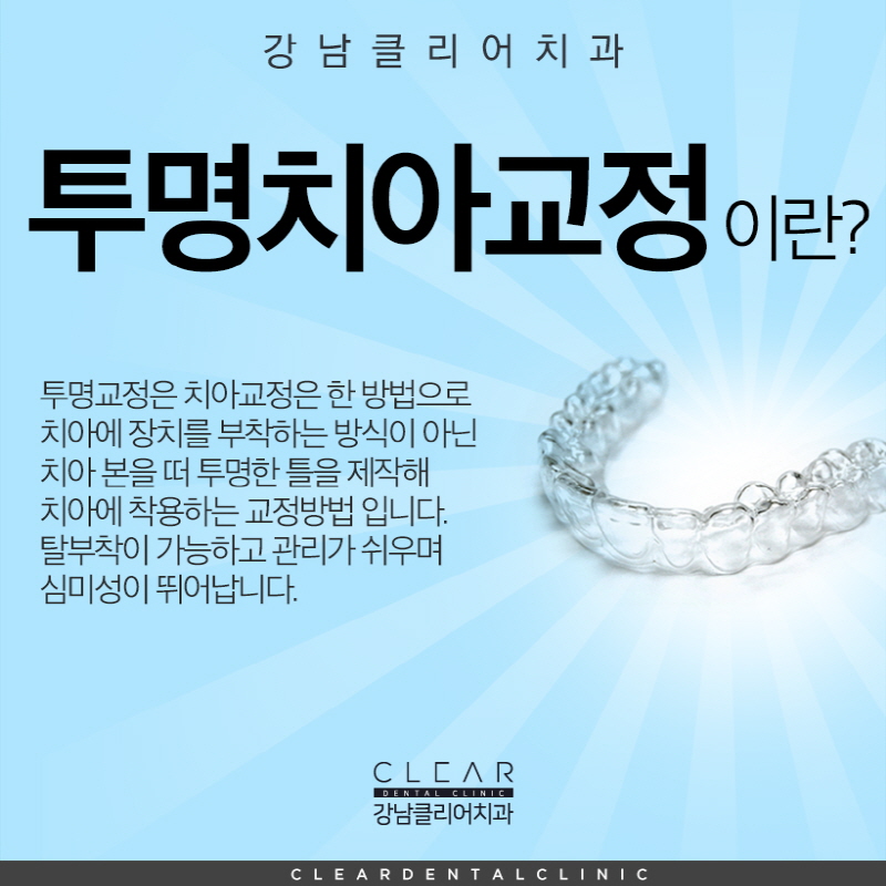 강남역 투명교정 가격 후기 치과 투명교정치료 모든것 관련 이미지 2