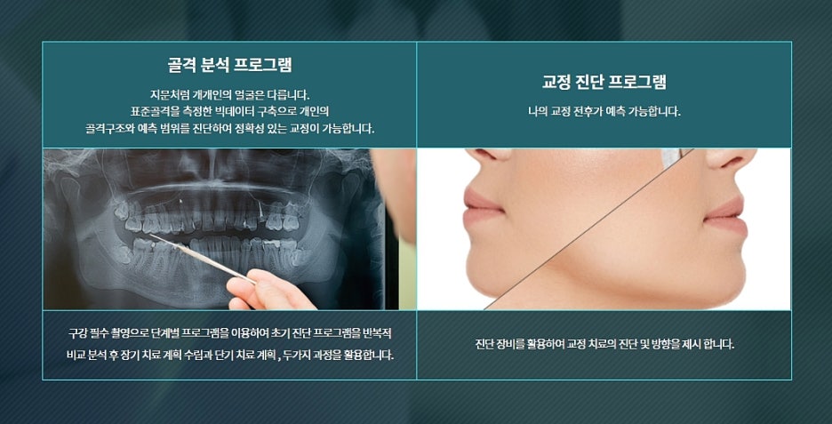 강남 치아교정 꼼꼼하게 알아봐야지 관련 이미지 3