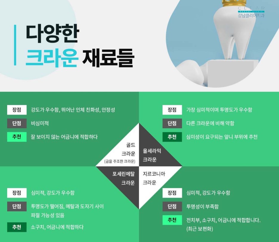 강남클리어치과 신경치료 필요할때 증상 기간은? 관련 이미지 6