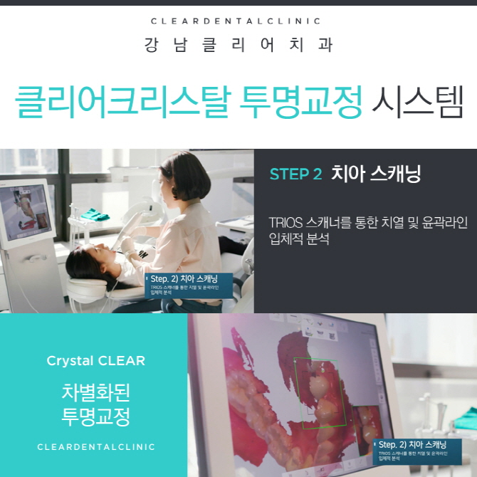 강남역투명교정 차별화된 클리어크리스탈 투명교정 알아보기 관련 이미지 5