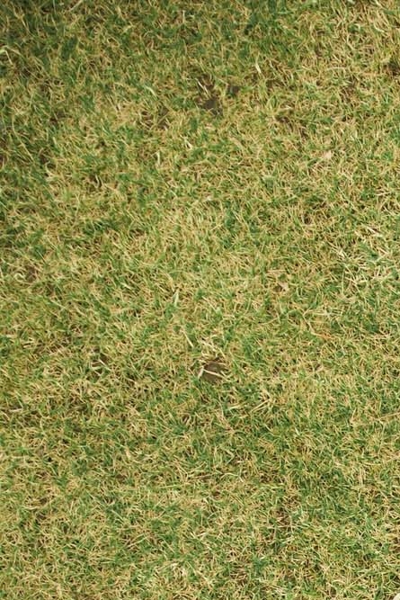 강남역 치과 임플란트 구조와 치료기간 관련 이미지 25