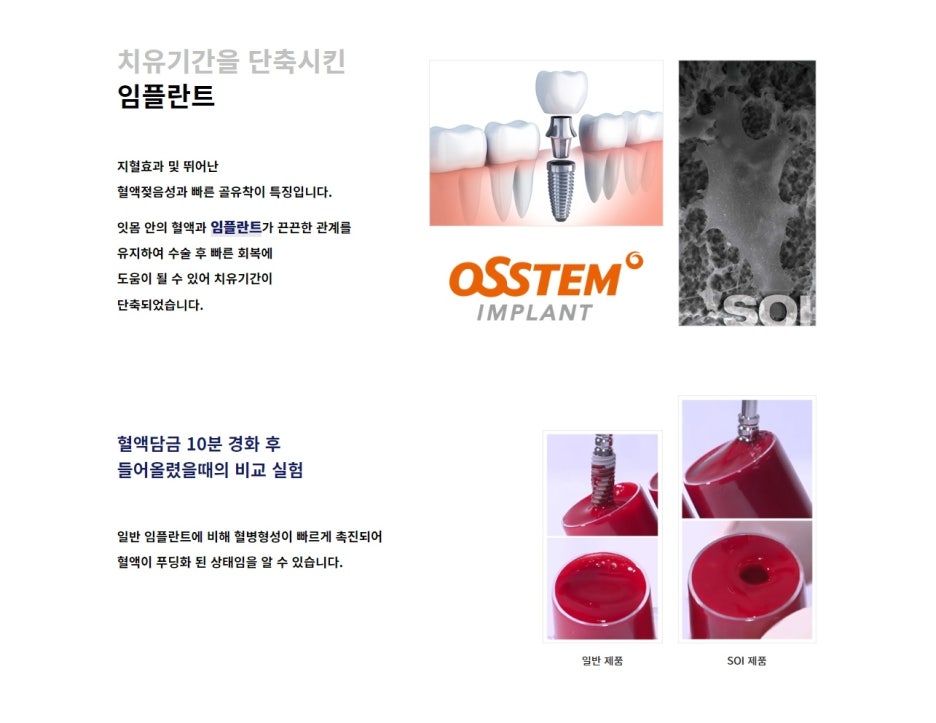 강남구 임플란트치과 후기 괜찮은 곳은? 관련 이미지 8