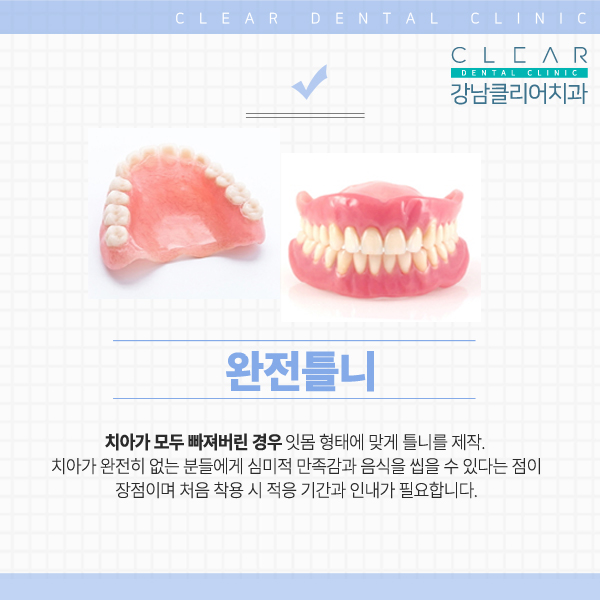 강남역치과 추천 치아 보철치료 관련 이미지 9