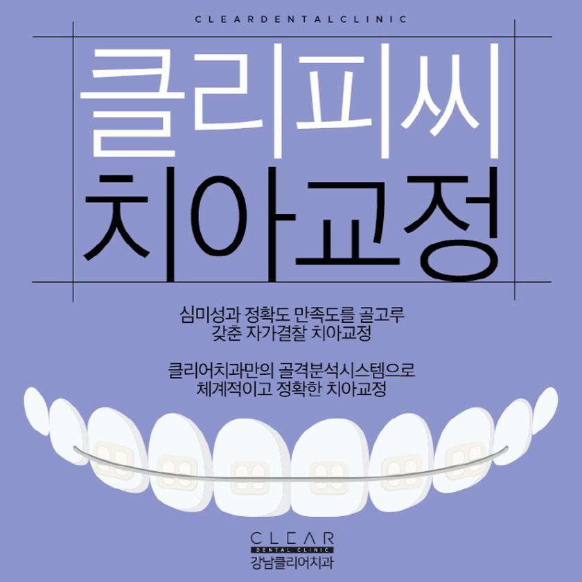 클리피씨교정비용 가격 이벤트로 혜택받기 관련 이미지 1
