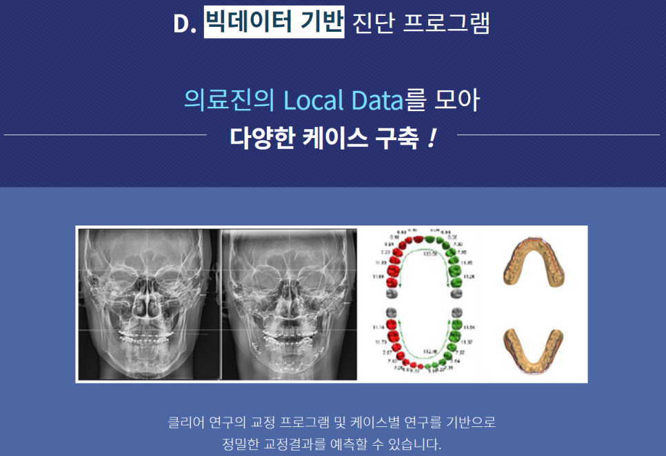 앞니 부분교정 비용 불편함이 적은 클리피씨 관련 이미지 9