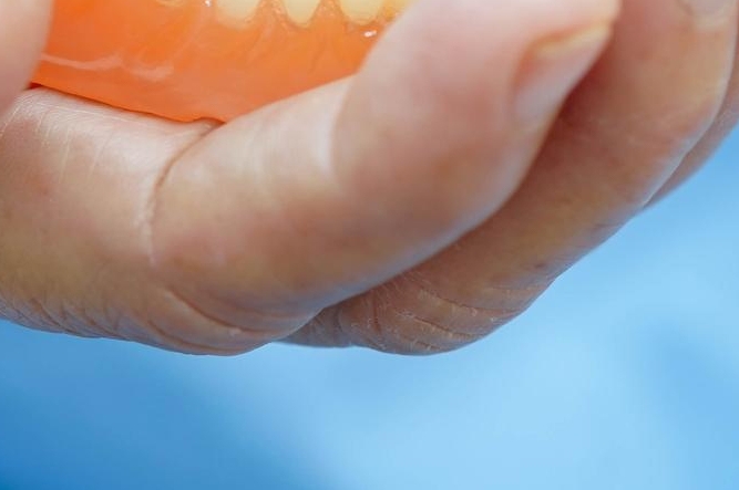 신경치료 후 통증이 생기는 이유 관련 이미지 31