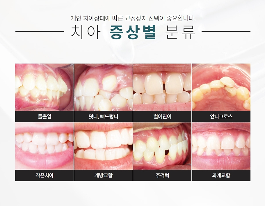 클리피씨 장점 여부를 모르겠다면? 관련 이미지 6