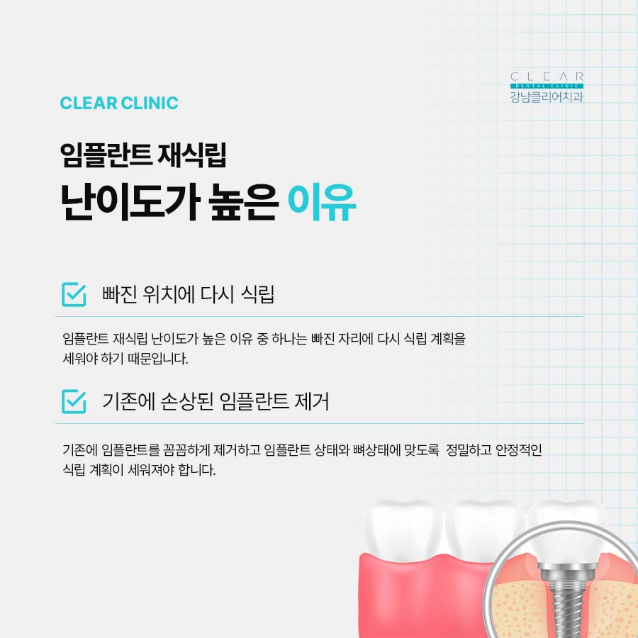 임플란트 재식립 재수술 난이도가 높은 이유 관련 이미지 3