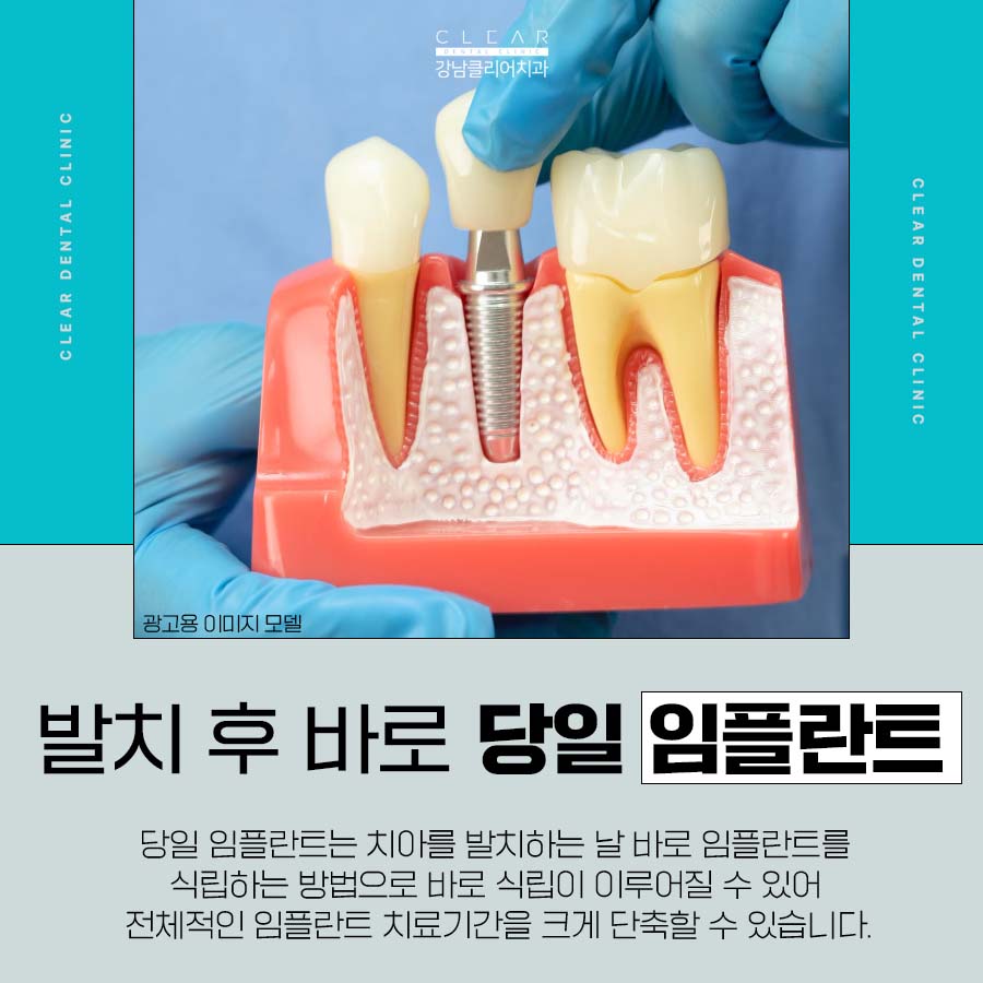 역삼 당일 임플란트 이러한 분들에게 좋아요 관련 이미지 2