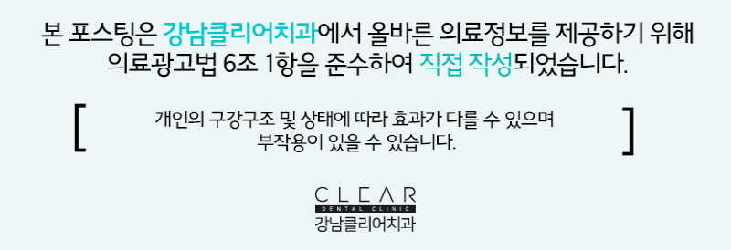 원데이 치아미백 금액 비용과 효과 알아보기 관련 이미지 9